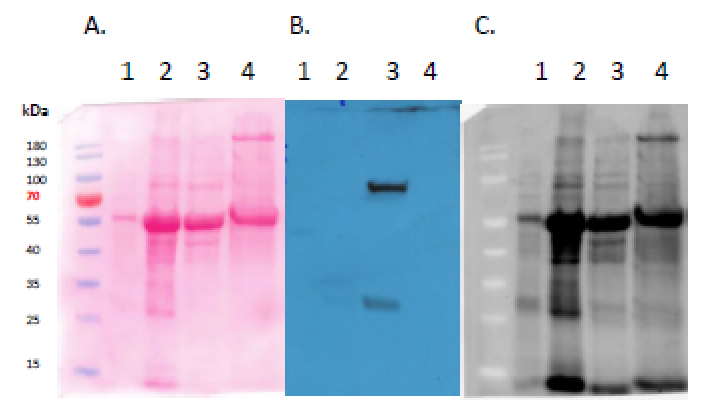 Western blot using anti-GFP antibodies'